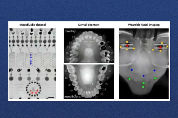 厚度仅0.94毫米！超薄仿生相机能实现140&deg;超宽视角