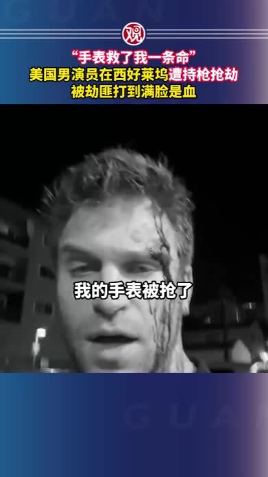 “手表救了我一条命”，美国男演员在西好莱坞遭持枪抢劫，被劫匪打到满脸是血