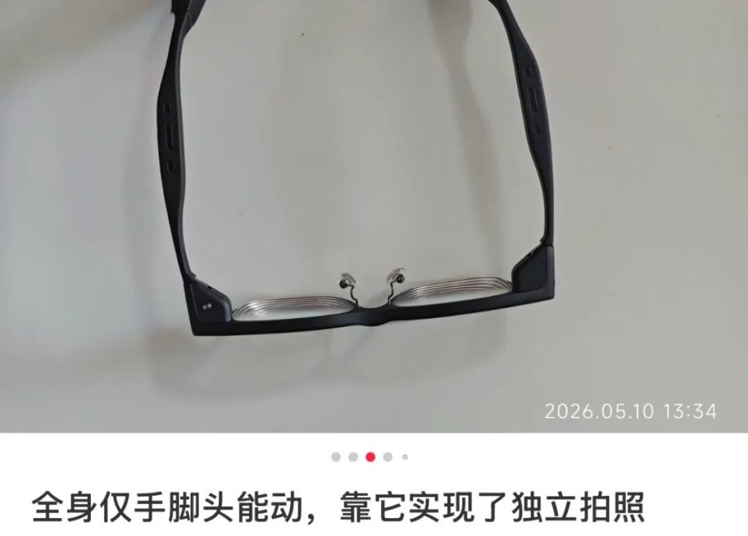 △罕见病患者王先生分享智能眼镜使用心得。
