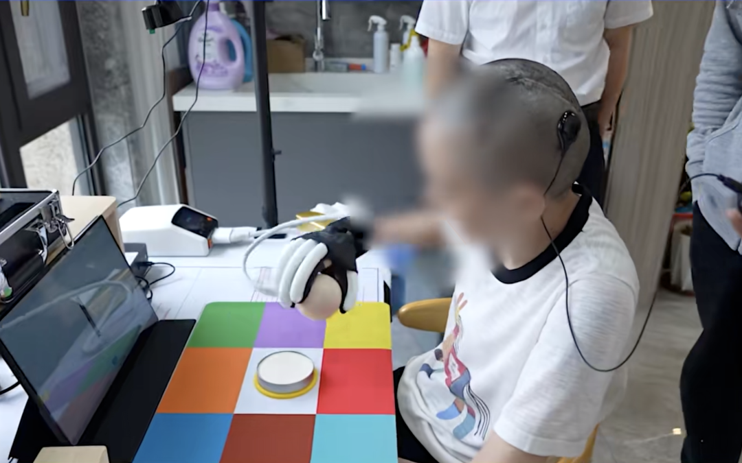 张学会练习在气动手套辅助下抓握木球 / 图源:江苏省人民医院南医大一附院官微