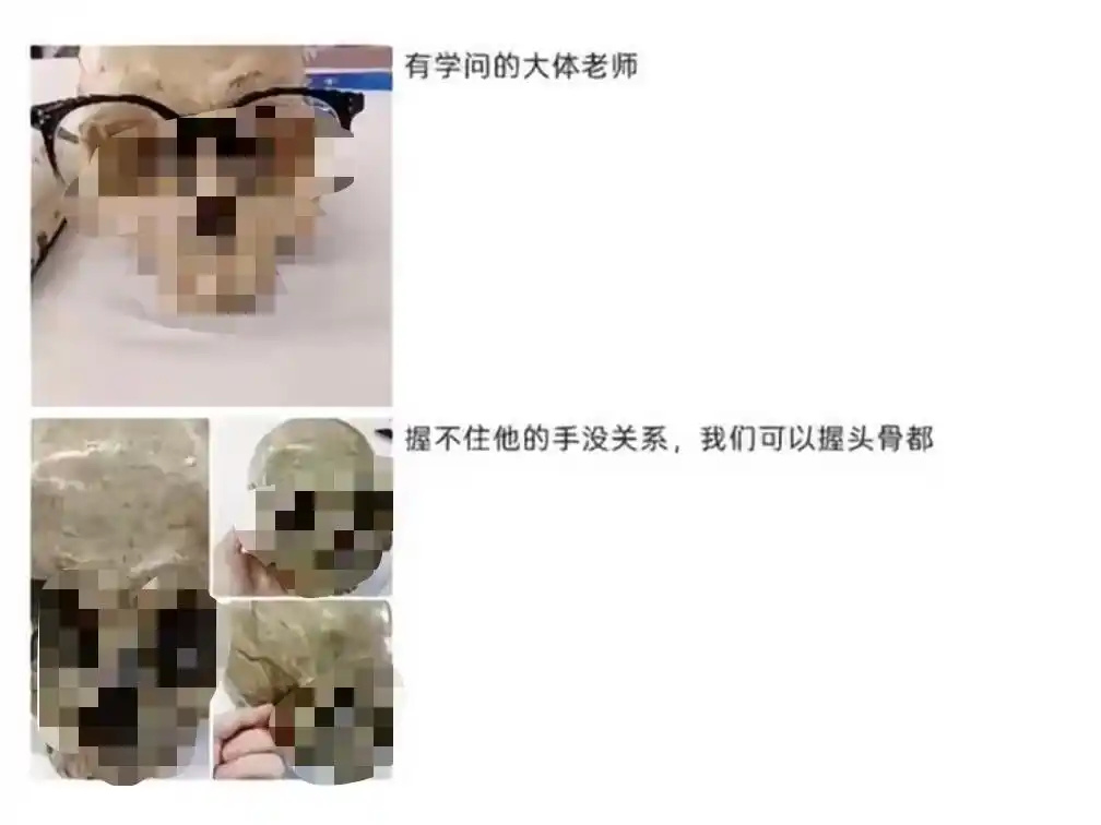 医学生在大体老师骨骼上写字取乐别让一些医学生破坏了遗体捐献的信任【“