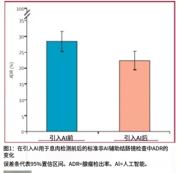 把大脑外包给AI之后 人类正在集体变笨