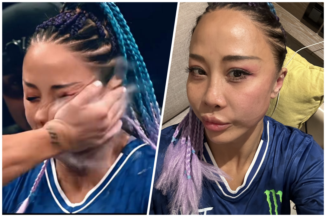 左图:丁苗参加扇耳光大赛被击打瞬间 图/视频截图