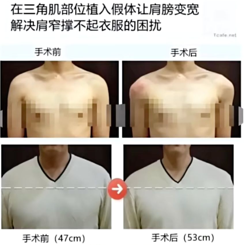 相关宣传