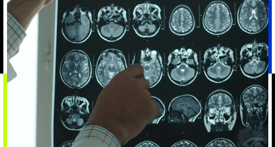 315能给质量差的“前额叶”也打个假吗?