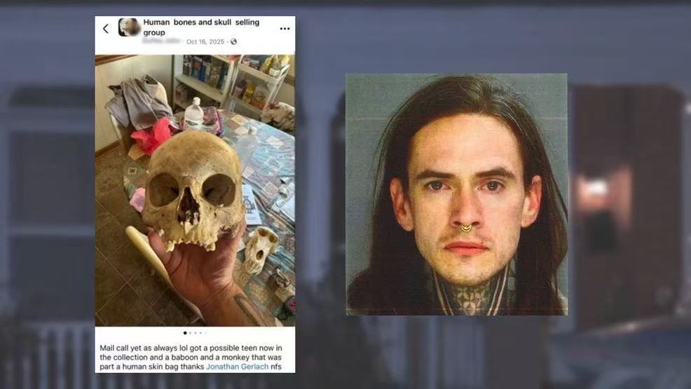 “人骨和头骨销售小组”群组截图与乔纳森·格拉赫的照片。图自美媒