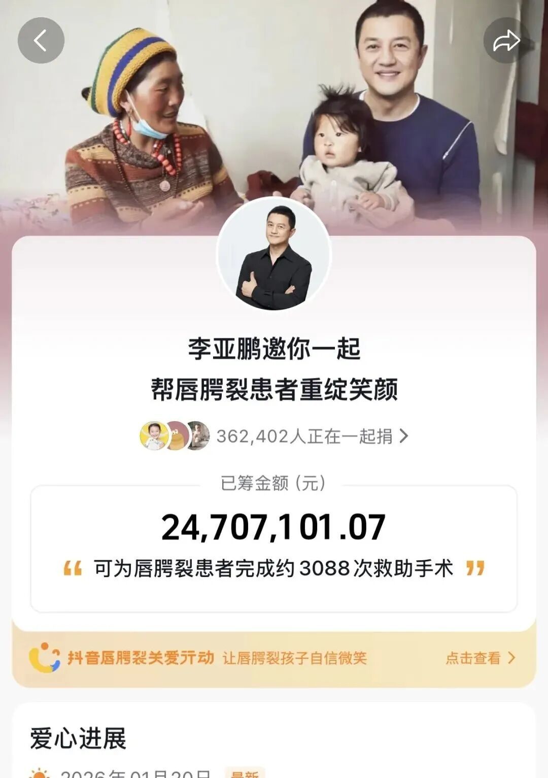 “李亚鹏邀你一起帮唇腭裂患者重绽笑颜”公益项目,目前该项目已下线 图源:抖音截图