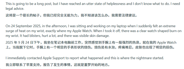 苹果Apple Watch灼伤手腕!更痛的是心寒:维权半年处处碰壁