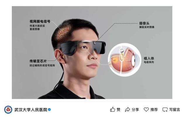 示意图