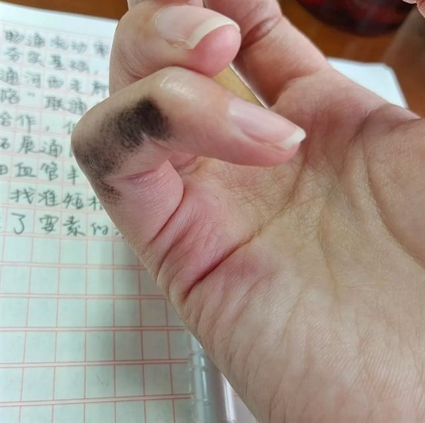 一块橡皮卖了100万 小学生文具在拼多多上杀疯了