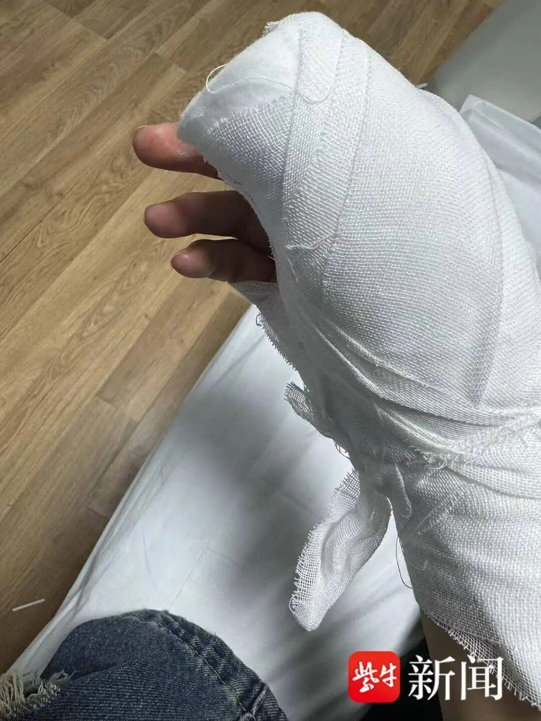 费先生手术后打石膏