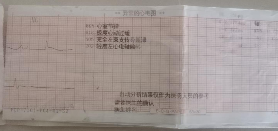 心电图提示“极度心动过缓”