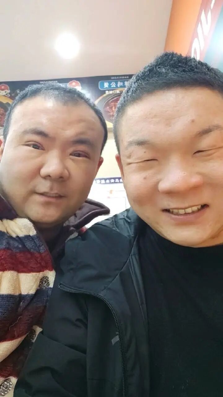 割完双眼皮的崔磊(左)和弟弟。