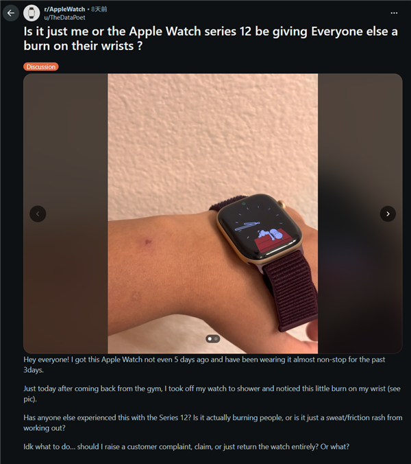 苹果Apple Watch S12被曝引发皮肤不适!有用户佩戴后手腕发红、出现灼烧感