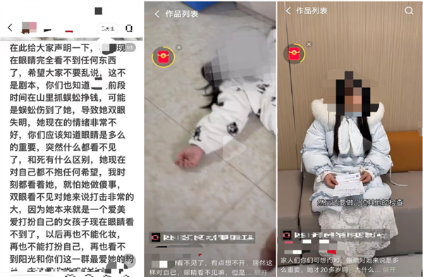500万粉丝博主流弊摆拍被握：指责握蜈蚣致失明