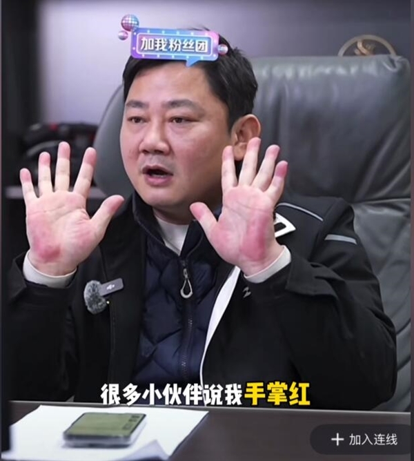 张雪手掌太红 大批网友提醒及时就医 三甲医生:要结合症状综合判断