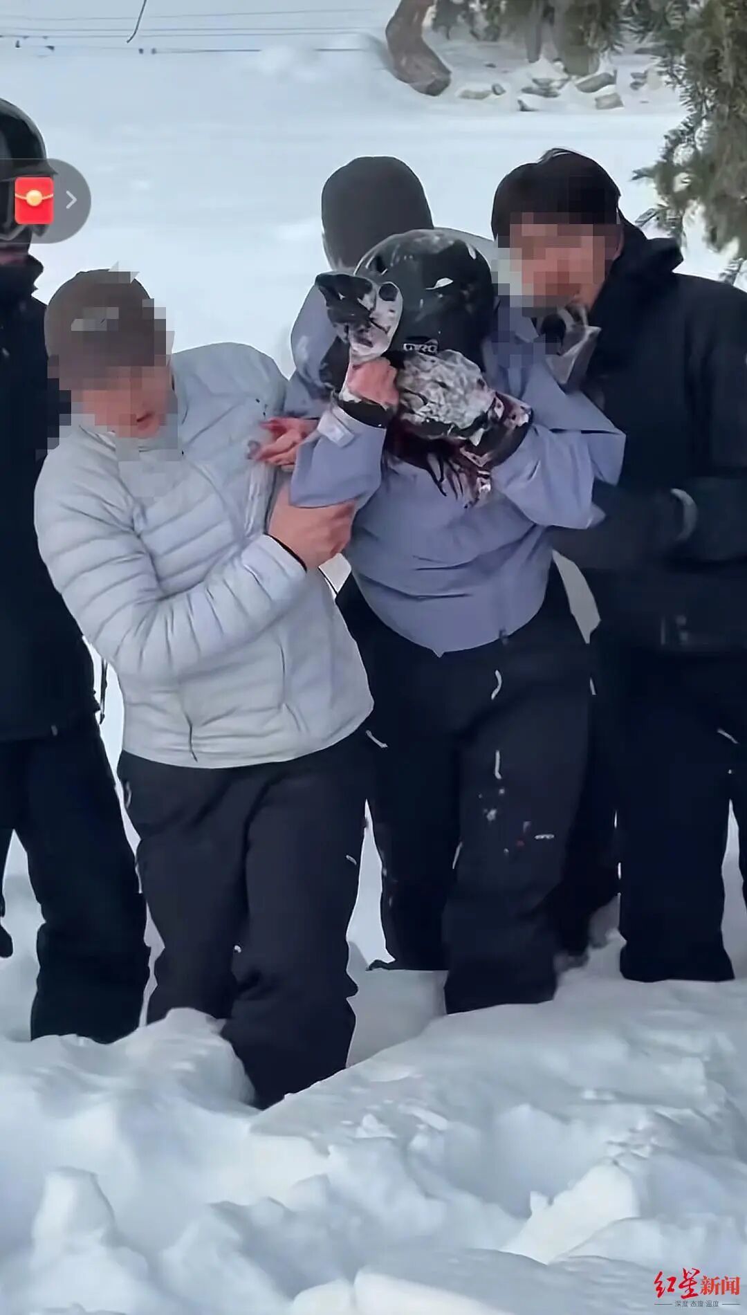 ▲女子被众人救起