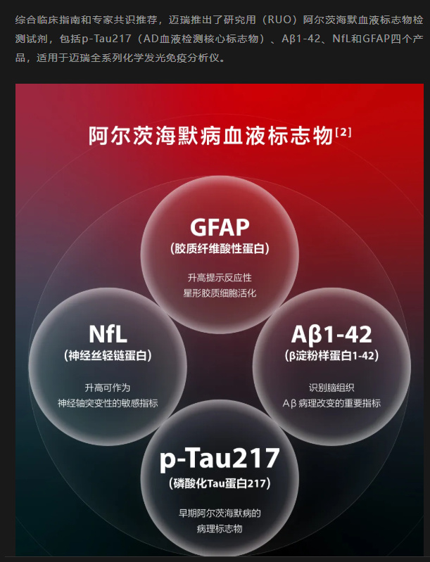 偶尔忘事不一定是老年痴呆 阿尔茨海默病新药仍难治愈 【“一管血”能测