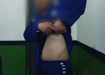 缅北电诈回流人员：那时候不要说一个肾了，锯条腿我都愿意，只要能走 由