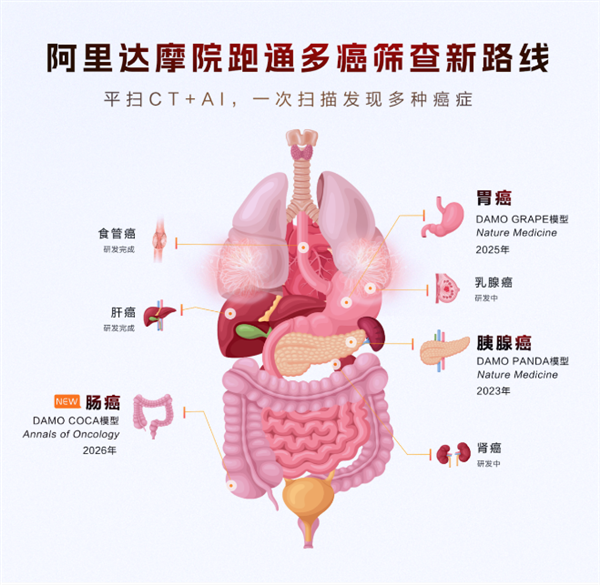 阿里发布第三个癌症AI模型：接连突破胰腺癌、胃癌、肠癌筛查难题