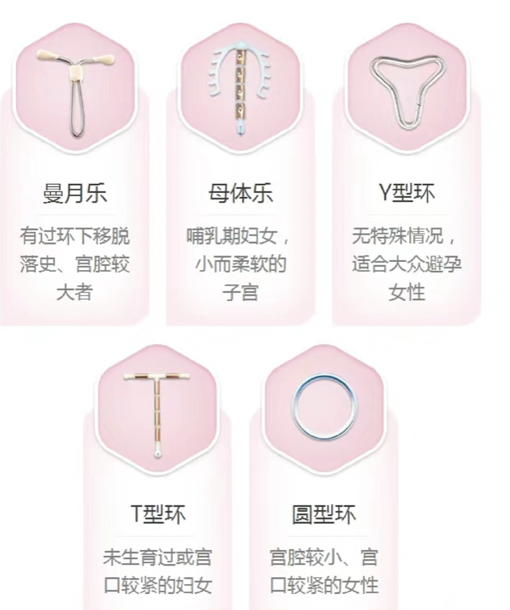 各种类型的节育环