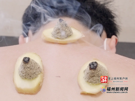 好医声|三伏天临近“冬病夏治”正当时 福州医生提醒:勿盲目跟风