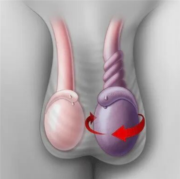 14岁男孩睾丸疼 亲妈迷信AI硬拖两天！终末只可切掉了