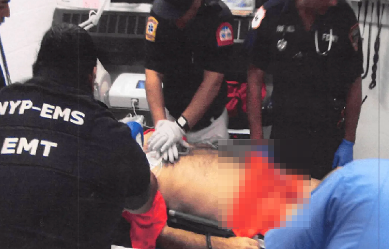 ▲急救人员正在对爱泼斯坦进行心肺复苏