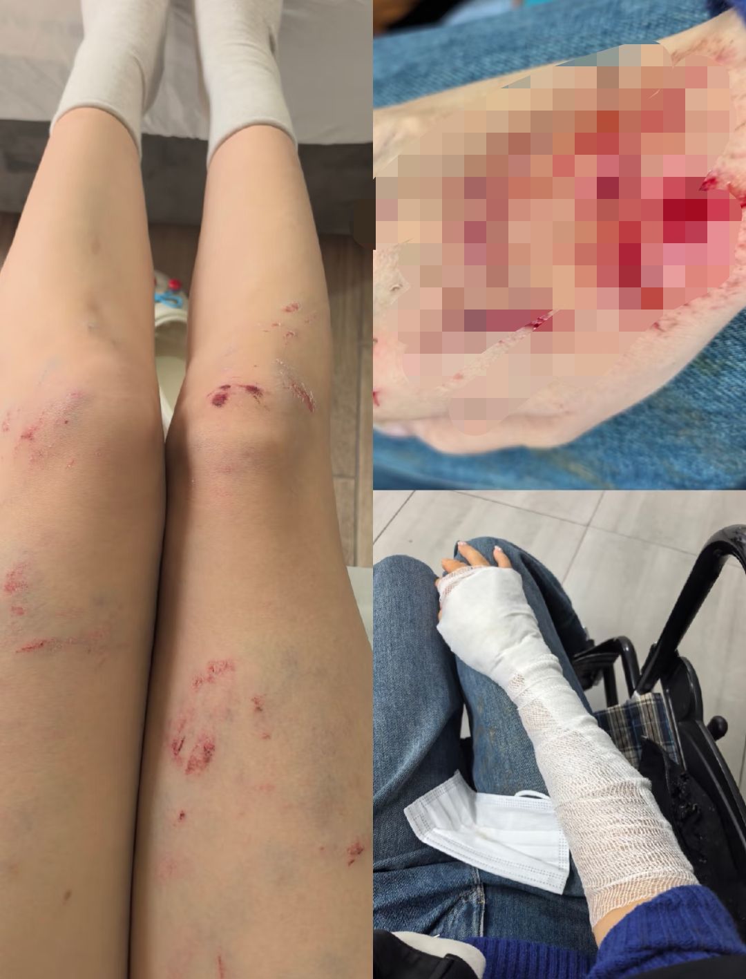 当事人玩滑翔伞受伤