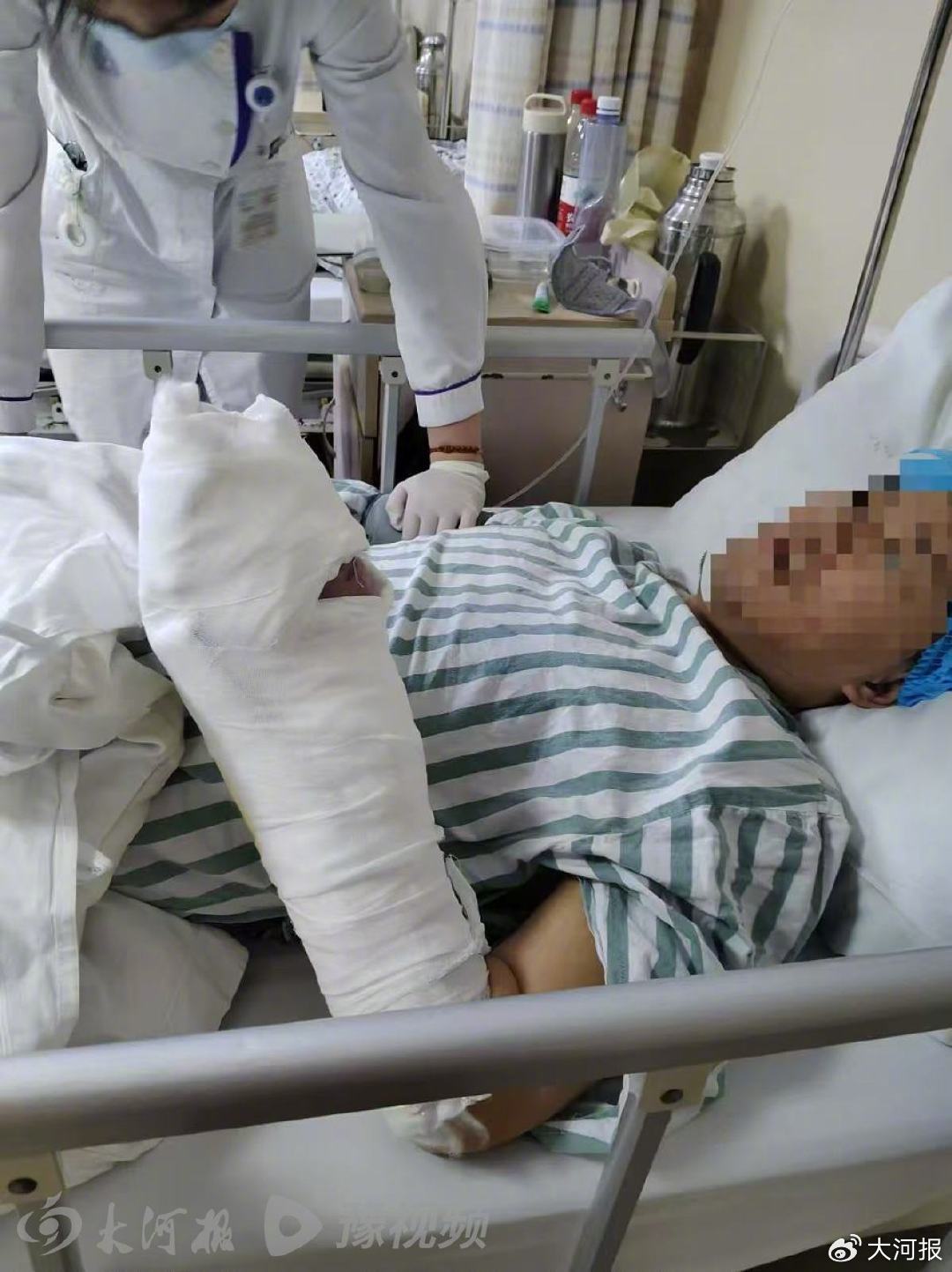 陈刚在医院接受治疗