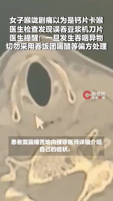 女子以为是钙片卡喉结果是误吞刀片