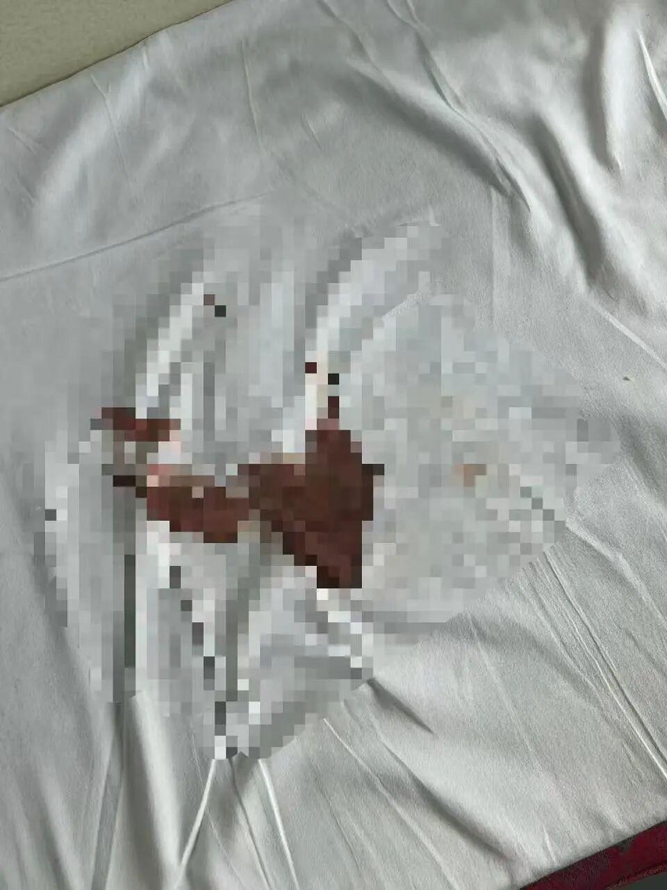 张女士不慎弄脏床单(受访者供图)