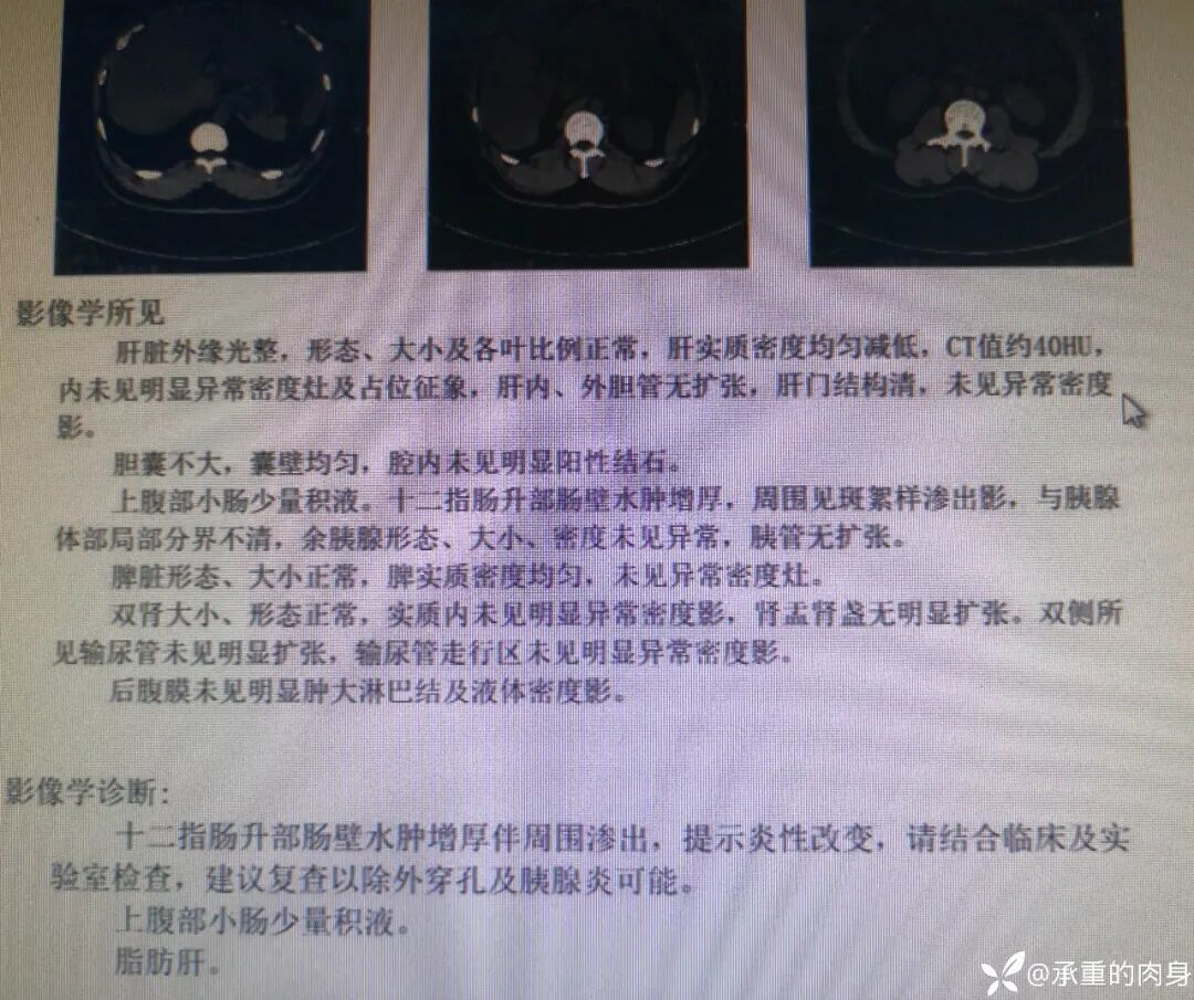 活久见！急诊上演「抢人」大战，内科外科争着收，最后患者自己选了…