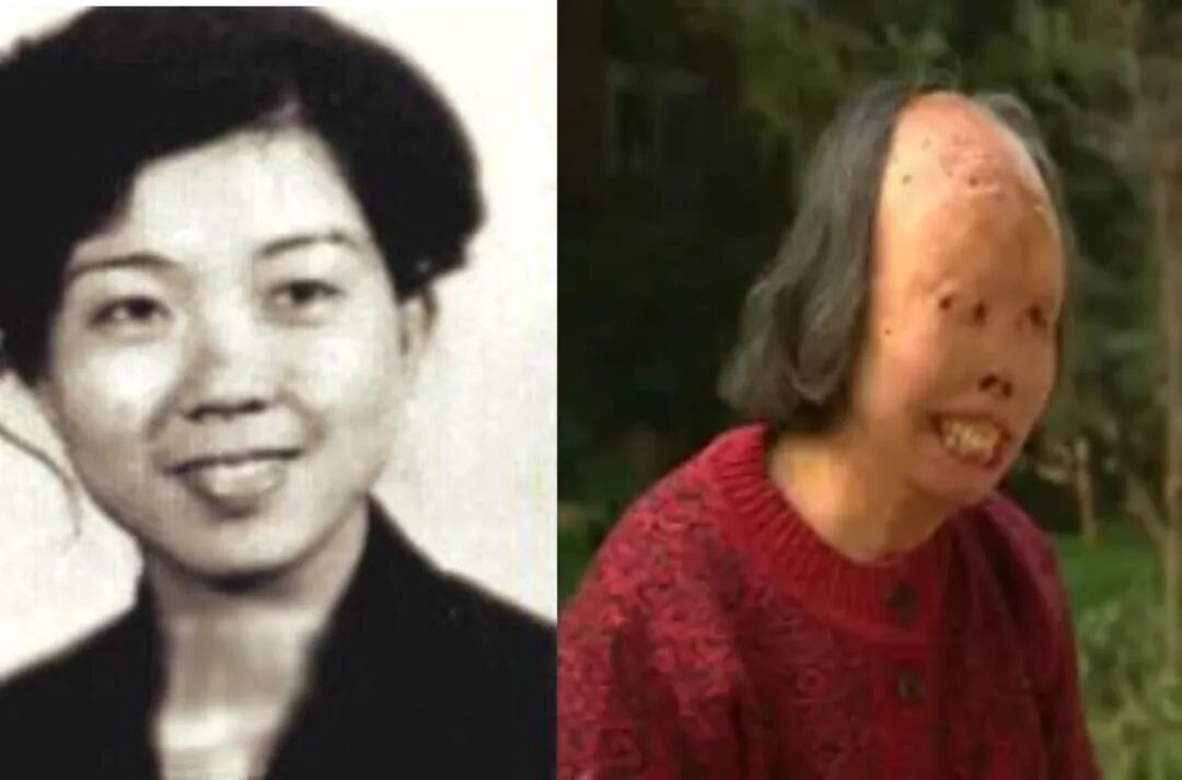 ▲自焚前后的郝惠君