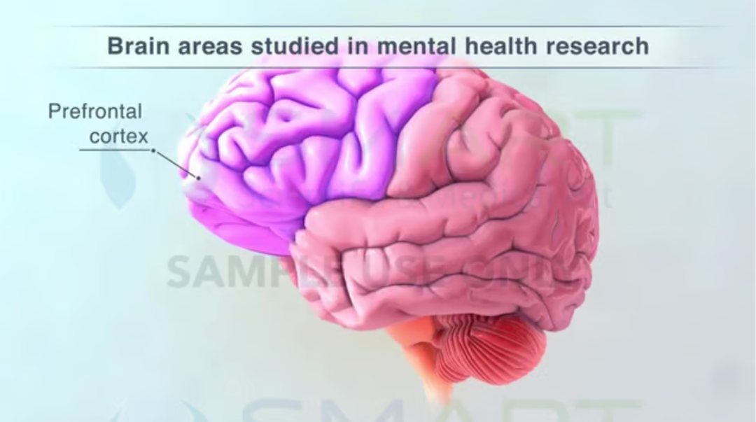 315能给质量差的“前额叶”也打个假吗?