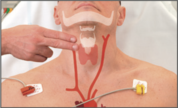 体魄这两个部位乱推拿真的会要命!快罢手