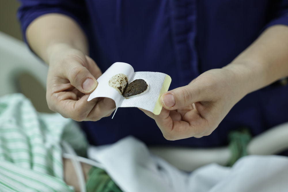 2月12日15时许，一名护士在重症监护室为患者进行中药贴敷治疗。