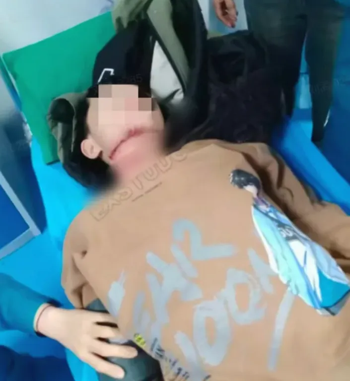 受伤少年在治疗中。（视频截图）