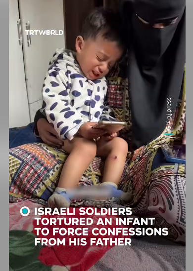 18月大的贾瓦德·阿布·纳萨尔身上可见伤口,被以色列开释后不断哀哭。 土耳其播送电视公司