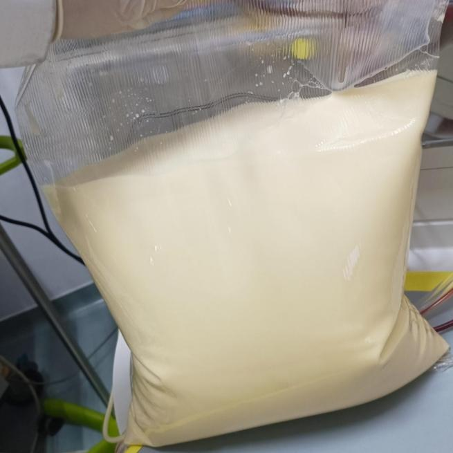 “牛奶血”——乳糜血