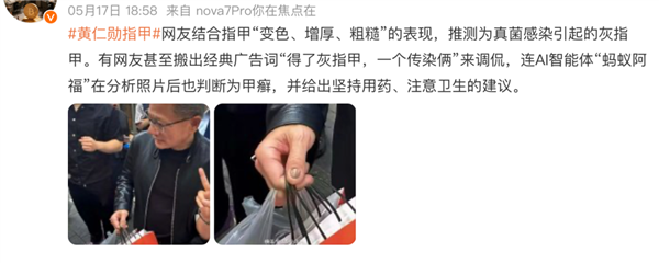 科技大佬也躲不过!黄仁勋的指甲被网友云诊断成灰指甲 医生回应