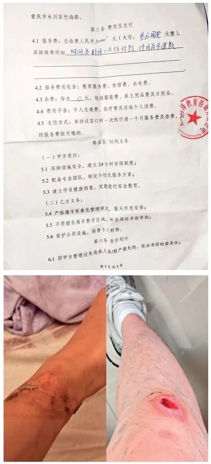 上图:梁宇父母与“戒网瘾”机构签署的服务合同