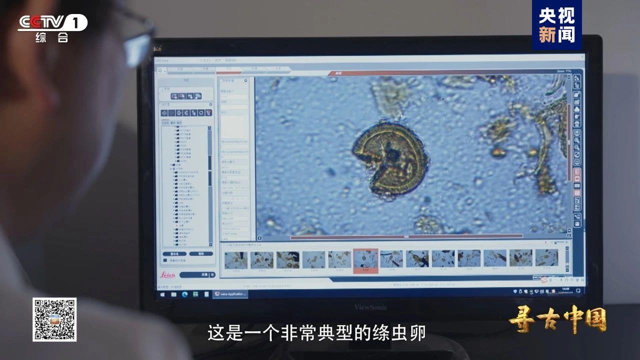 △湖北云梦郑家湖墓地墓主人骶骨中发现寄生虫卵