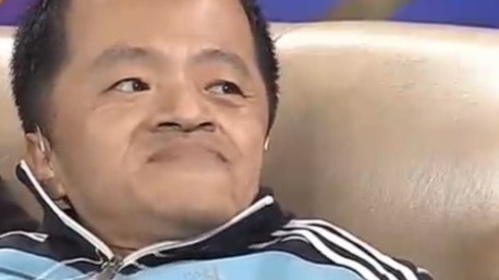 男子刚出生时脑袋有弹性 医生都觉得自己活不过一岁!