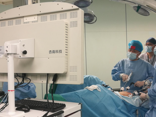 手术当日,由普外中心主任裘正军和副主任医师黄陈等专家组成的手术