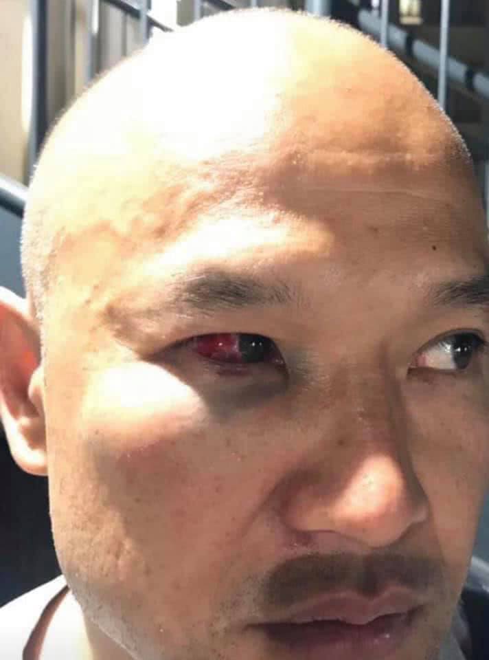 受伤香港警察只恨暴徒也是中国人打不是不打也不是