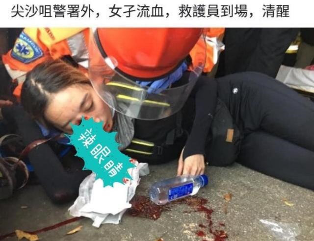 香港示威女子眼部受伤称被港警所伤 医护人员：非警队射击范围