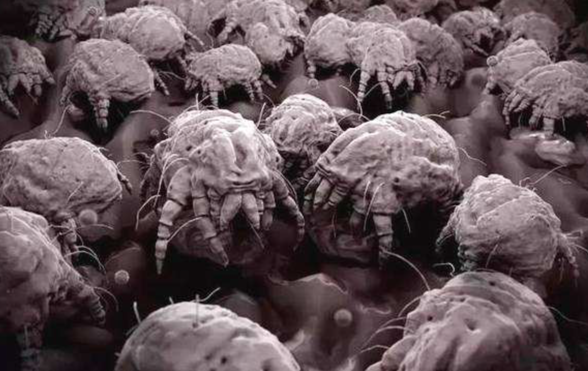 的皮肤还很稚嫩,身体的各个器官有些仍没有发育完全,每晚与螨虫入眠