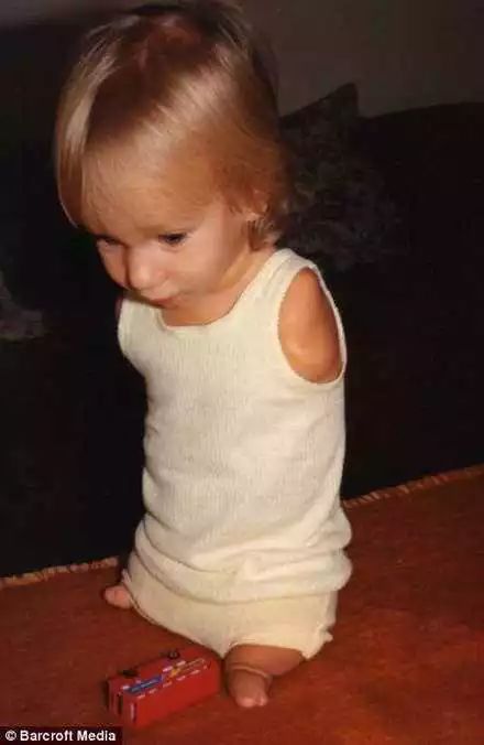 【悉尼印象】他是澳洲最“丑”男孩，连爸妈都嫌弃，长大逆袭亿万富豪轰动全世界....