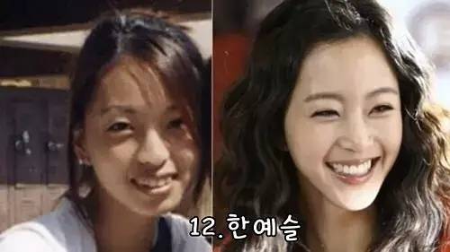 「Dispatch」出道整成“金喜善”，因太美被霸凌，如今40岁像18岁！